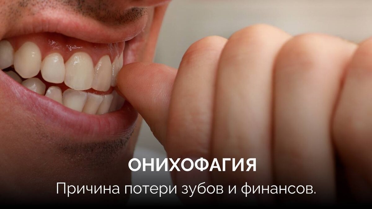 Онихофагия. Причина потери зубов и финансов.