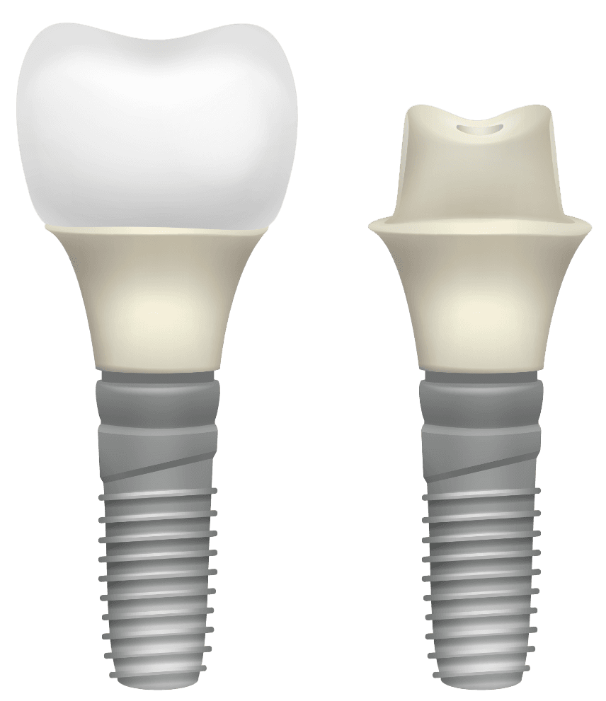 ЗУБНОЙ ИМПЛАНТ DENTIUM